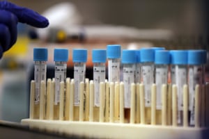 Vials with samples taken for the new coronavirus are counted before they are prepared for RNA testing at the molecular pathology lab at Tulane University School of Medicine in New Orleans, Thursday, April 2, 2020. The test is identical to the PCR test being used by the Centers for Disease Control to ease the testing crisis and stop the spread of COVID-19, which has hit the New Orleans area especially hard.